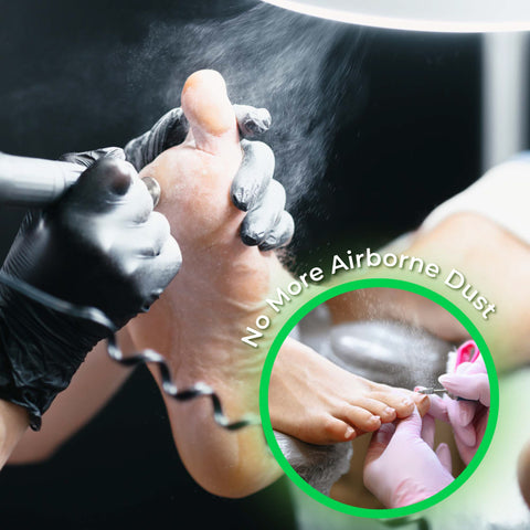 Alizé™-Nagelstaubabsaugung